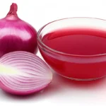 Onion remedy for boils